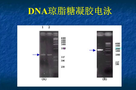 华为哪些手机带螺旋仪
:影响凝胶电泳仪移动的因素-第1张图片-太平洋在线下载